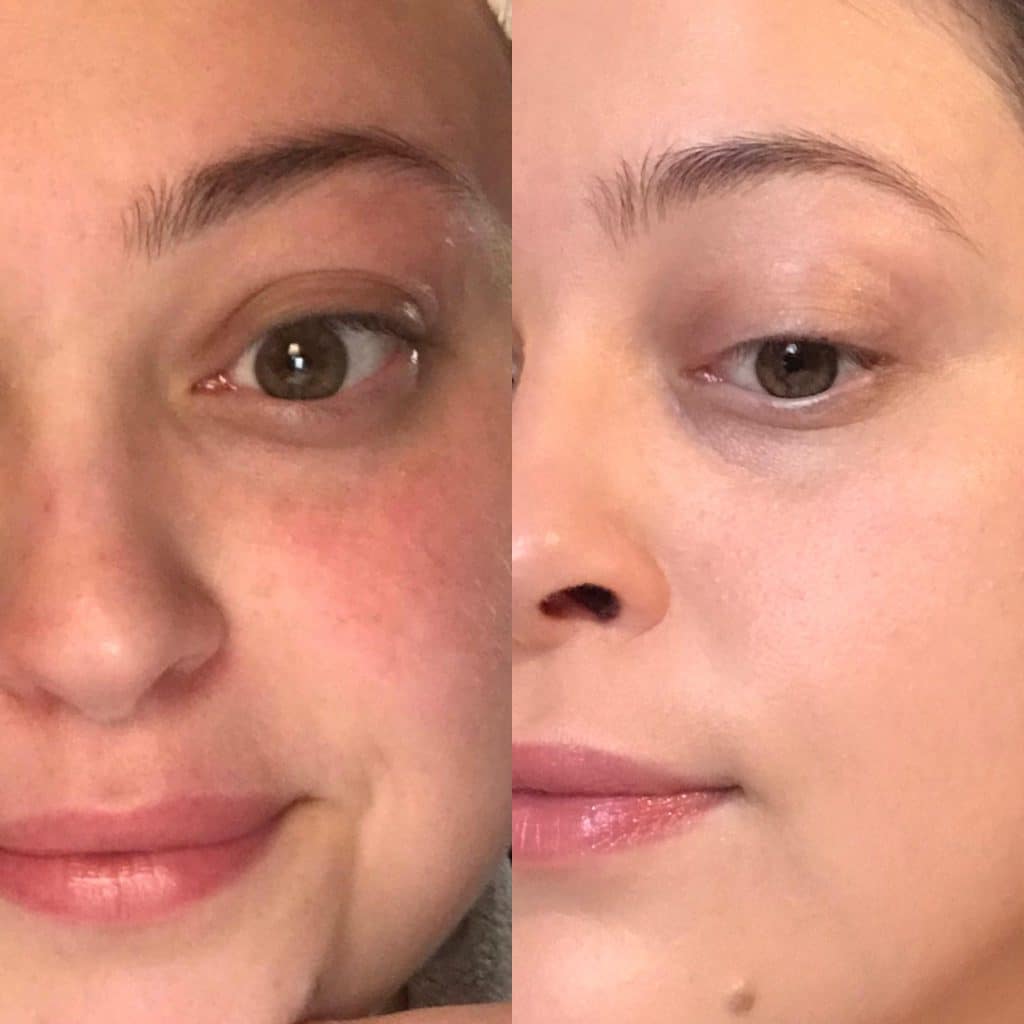 ژل کرم لایه بردار و روشن کننده نوتروژینا