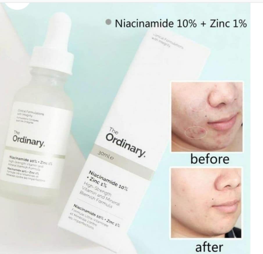 قبل و بعد استفاده از سرم نیاسینامد اوردینری