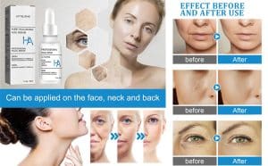 سرم ابرسان هیالورونیک اسید پروکسین