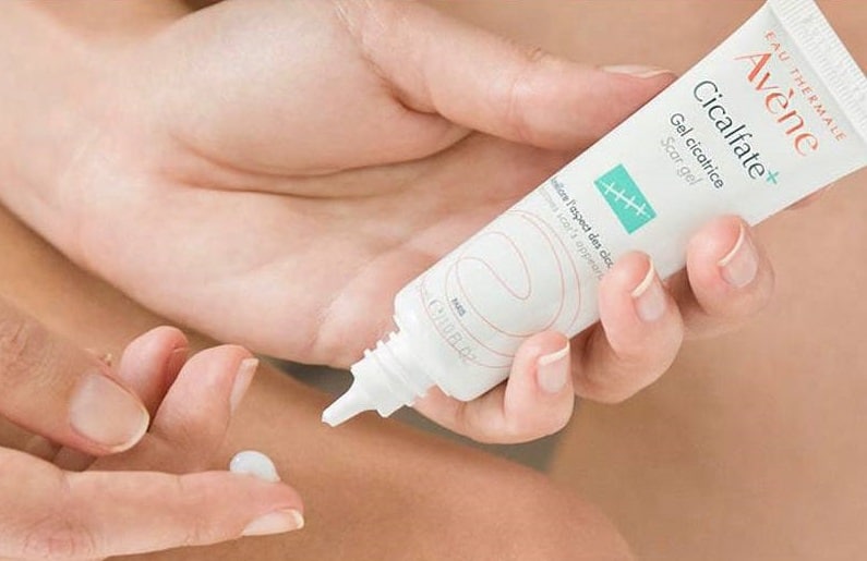 استفاده از ژل اسکار سیکالفیت اون ترمیم کننده بخیه