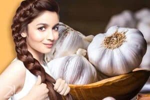 شامپو ردیست Redist سیر مدل ضد ریزش