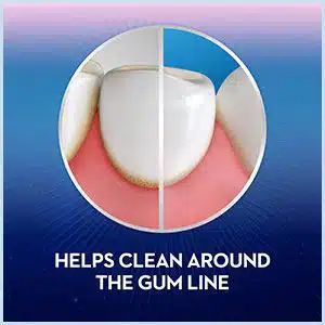 اورال بی گام اند اینمال