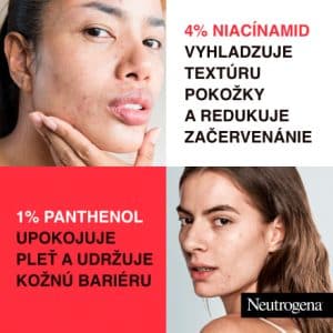 ژل آبرسان و ضدجوش پلاس نوتروژینا Neutrogena