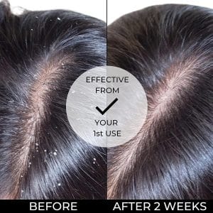 شامپو ضد شوره رولون