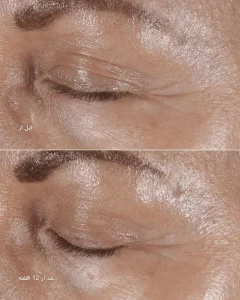 دور چشم ضد چروک و جوانساز کلینیک مدل Smart Clinical Repair