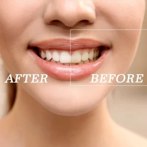 خمیر دندان دنتا مکس الکوس Zahnweiss