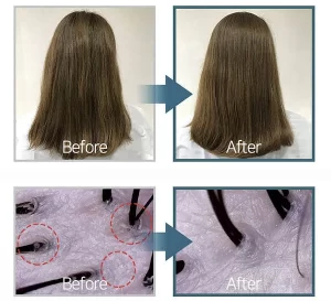 شامپو فورست استوری مو های چرب مدل B7