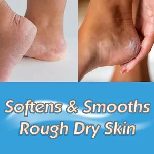 کرم شب ترک پا اوکیفس Night Treatment