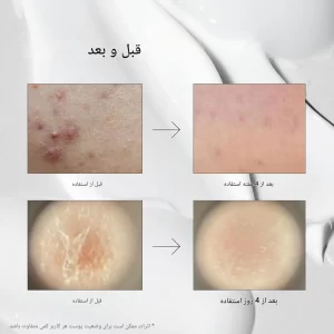 سرم ترمیم کننده میکرونیدلینگ ریدل شات 100