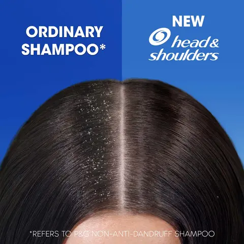 شامپو شولدرز