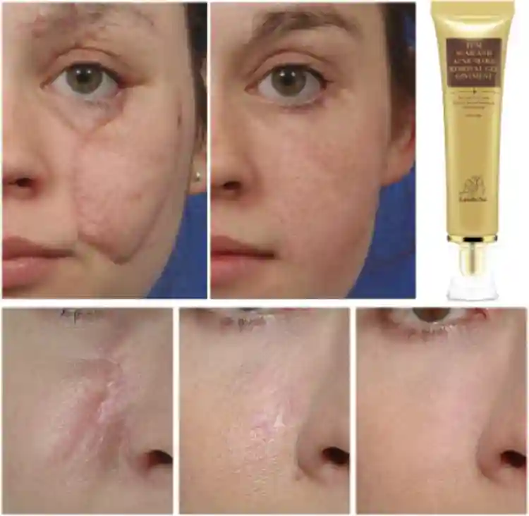 ژل ترمیم کننده لانبنا